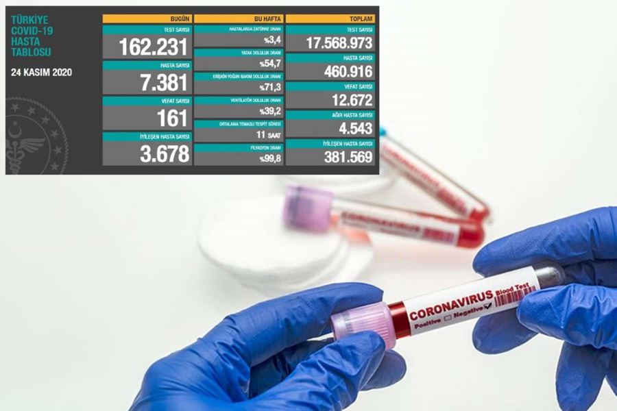 Türkiye’de son 24 saatte 7381 Coronavirus vakası tespit edildi