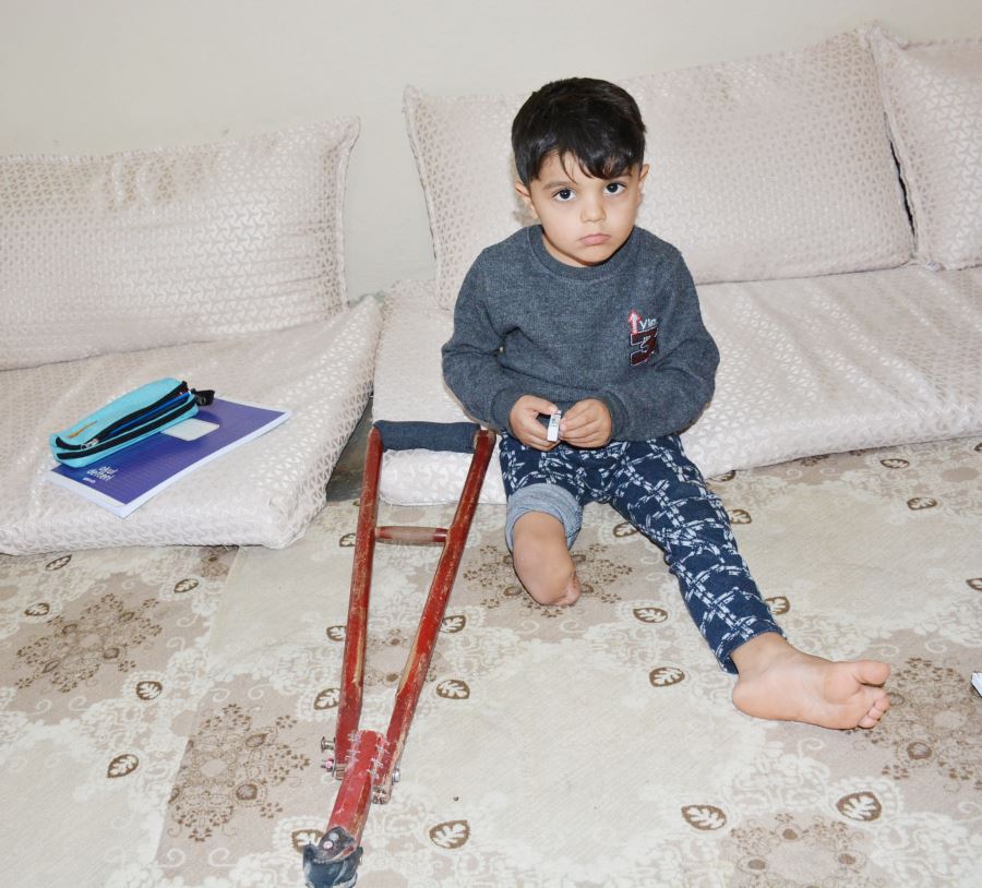 Küçük Muhammed protez bacağa kavuşacak